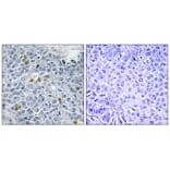 Immunohistochemistry - TOP2A (Phospho-Ser1106) Antibody from Signalway Antibody (12110) - Antibodies.com