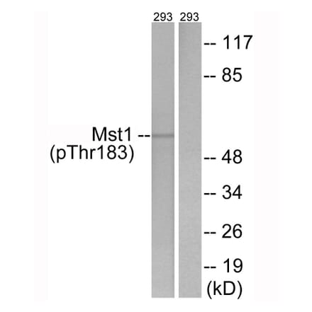 Western blot - Mst1 (Phospho-Thr183) Antibody from Signalway Antibody (12144) - Antibodies.com