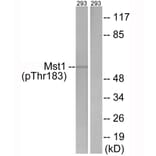 Western blot - Mst1 (Phospho-Thr183) Antibody from Signalway Antibody (12144) - Antibodies.com