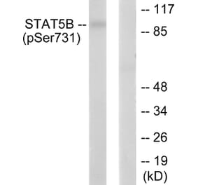 Western blot - STAT5B (Phospho-Ser731) Antibody from Signalway Antibody (12152) - Antibodies.com