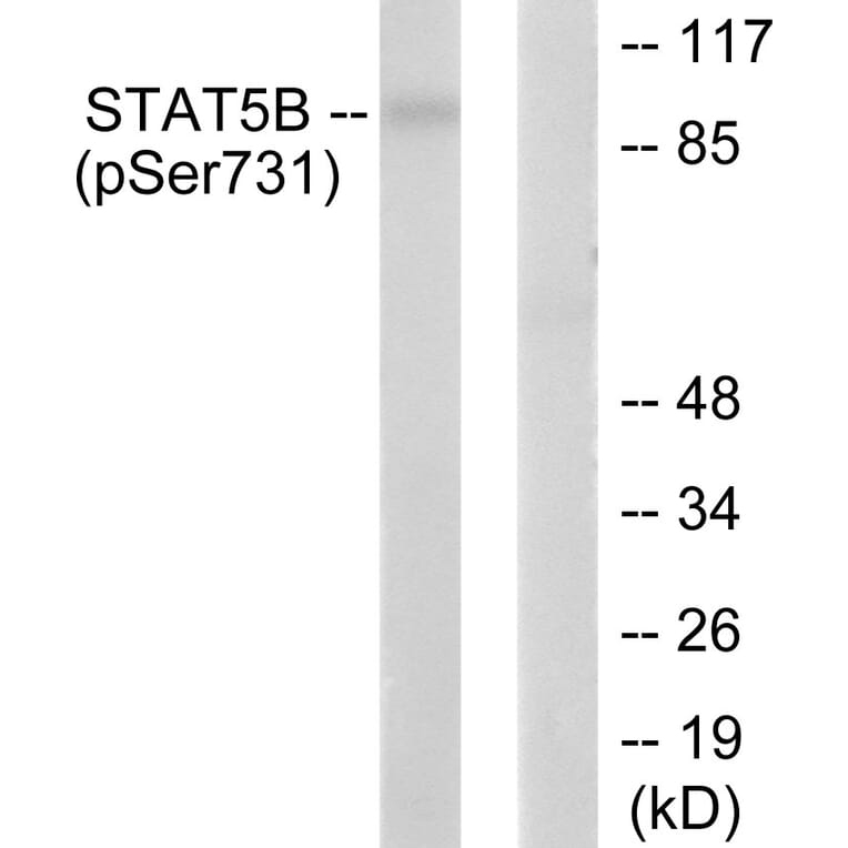 Western blot - STAT5B (Phospho-Ser731) Antibody from Signalway Antibody (12152) - Antibodies.com