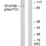 Western blot - STAT5B (Phospho-Ser731) Antibody from Signalway Antibody (12152) - Antibodies.com