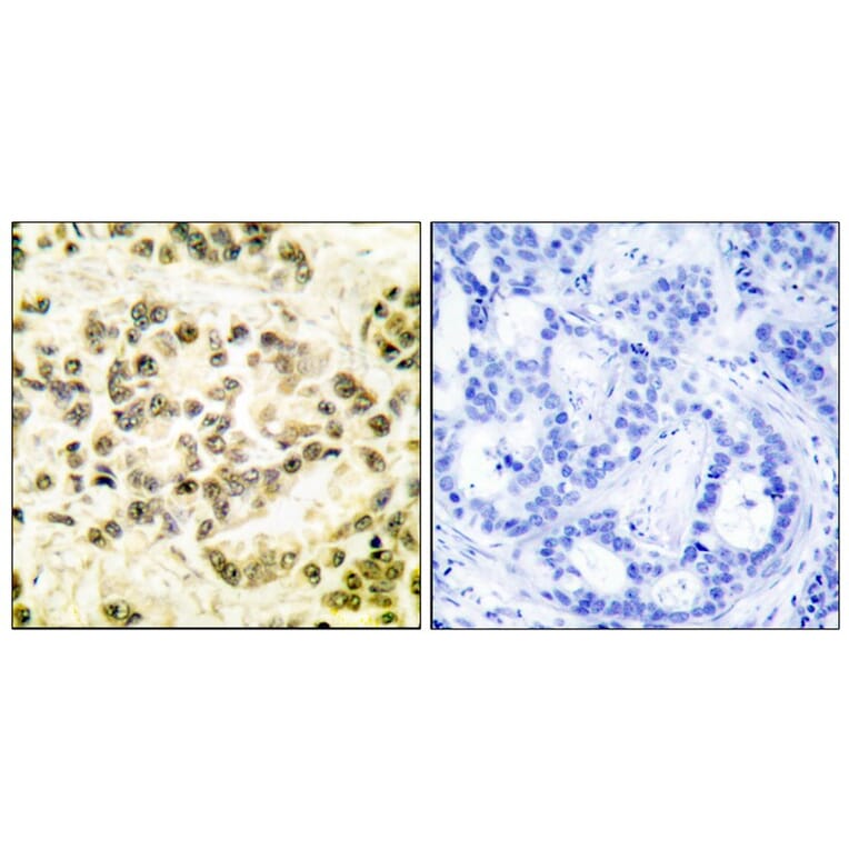 Immunohistochemistry - STAT5B (Phospho-Ser731) Antibody from Signalway Antibody (12152) - Antibodies.com