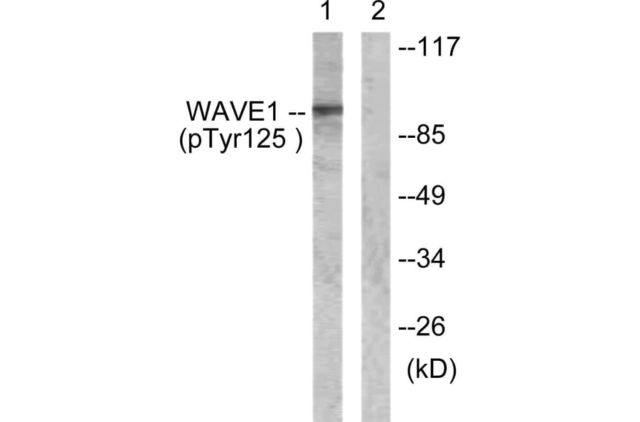 Western blot - WAVE1 (Phospho-Tyr125) Antibody from Signalway Antibody (12156) - Antibodies.com