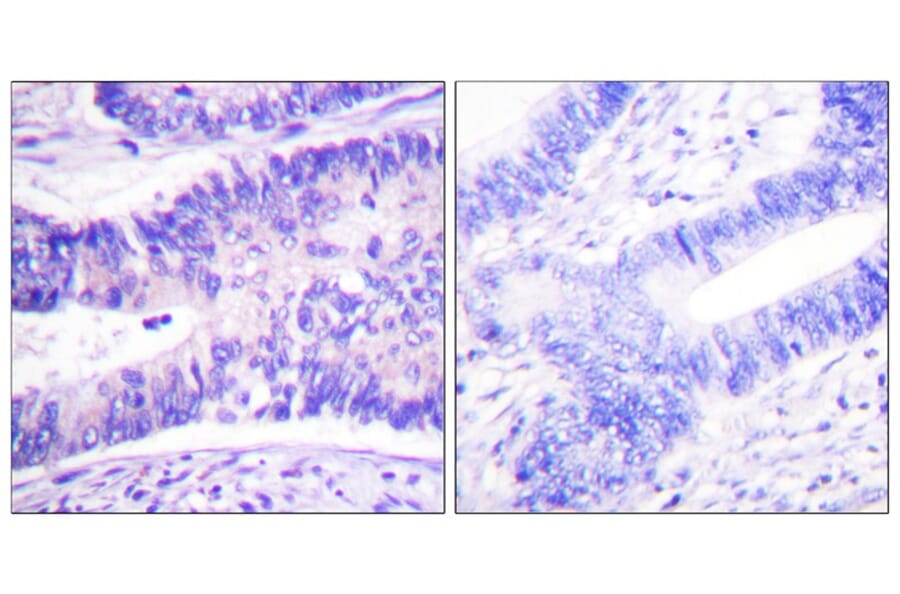 Immunohistochemistry - WAVE1 (Phospho-Tyr125) Antibody from Signalway Antibody (12156) - Antibodies.com