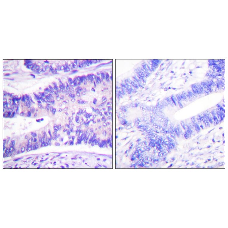 Immunohistochemistry - WAVE1 (Phospho-Tyr125) Antibody from Signalway Antibody (12156) - Antibodies.com