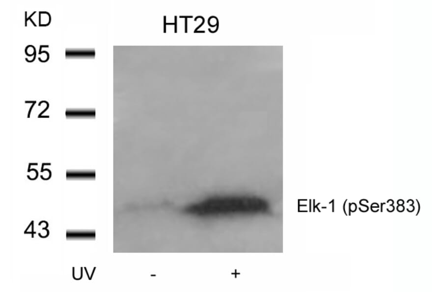 Western blot - Elk-1 (Phospho-Ser383) Antibody from Signalway Antibody (11004) - Antibodies.com