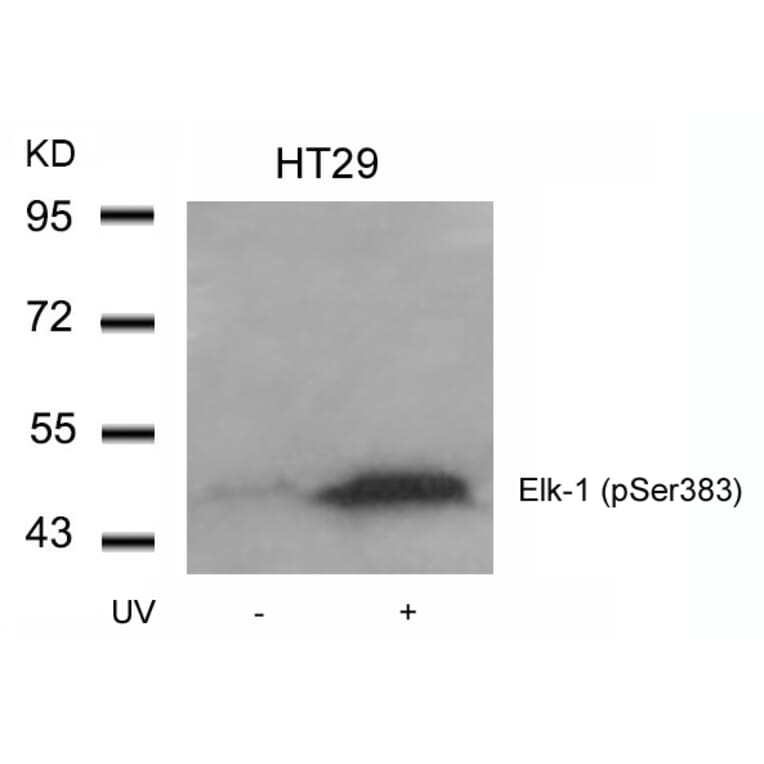 Western blot - Elk-1 (Phospho-Ser383) Antibody from Signalway Antibody (11004) - Antibodies.com