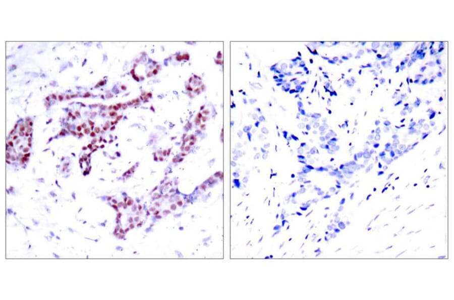 Immunohistochemistry - STAT1 (Phospho-Tyr701) Antibody from Signalway Antibody (11044) - Antibodies.com