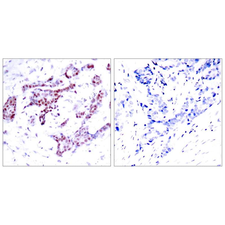 Immunohistochemistry - STAT1 (Phospho-Tyr701) Antibody from Signalway Antibody (11044) - Antibodies.com
