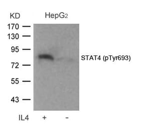 Western blot - STAT4 (Phospho-Tyr693) Antibody from Signalway Antibody (11047) - Antibodies.com