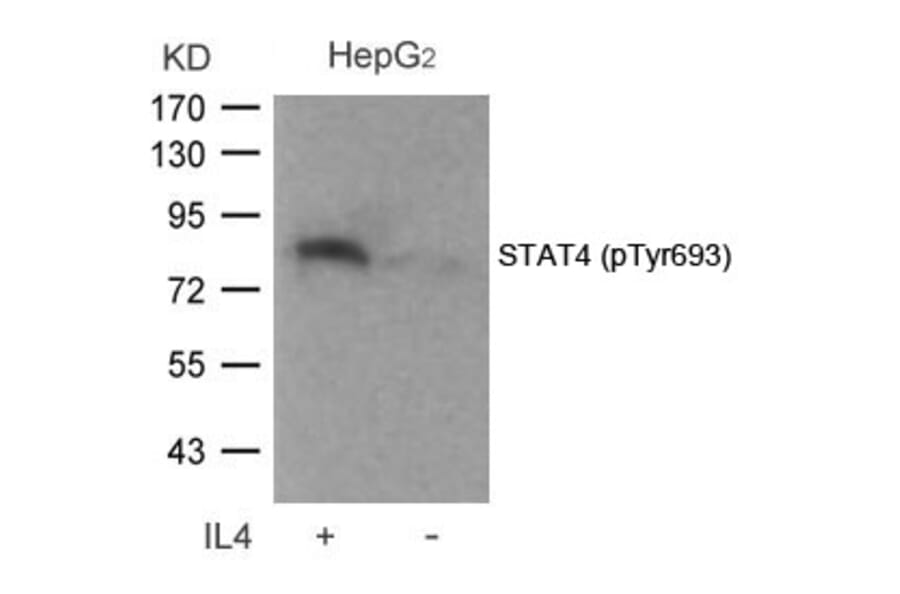 Western blot - STAT4 (Phospho-Tyr693) Antibody from Signalway Antibody (11047) - Antibodies.com