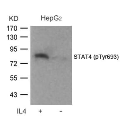 Western blot - STAT4 (Phospho-Tyr693) Antibody from Signalway Antibody (11047) - Antibodies.com