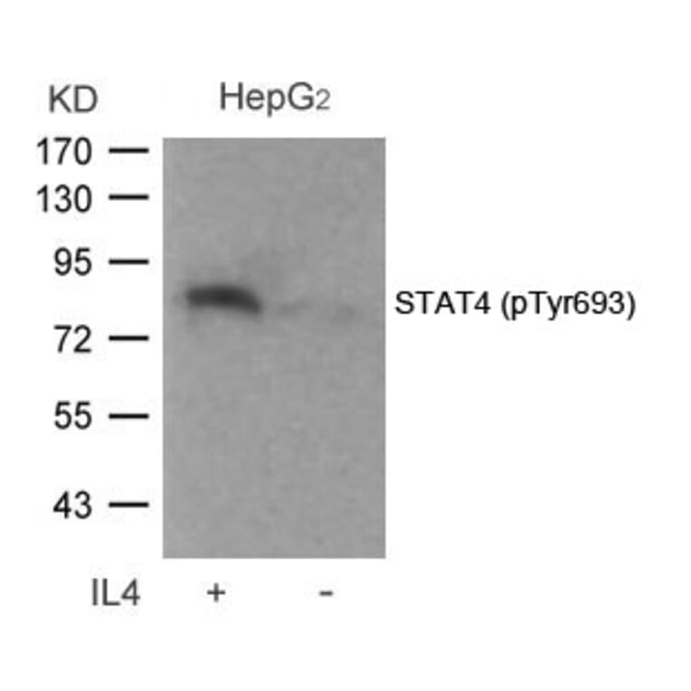 Western blot - STAT4 (Phospho-Tyr693) Antibody from Signalway Antibody (11047) - Antibodies.com