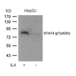 Western blot - STAT4 (Phospho-Tyr693) Antibody from Signalway Antibody (11047) - Antibodies.com