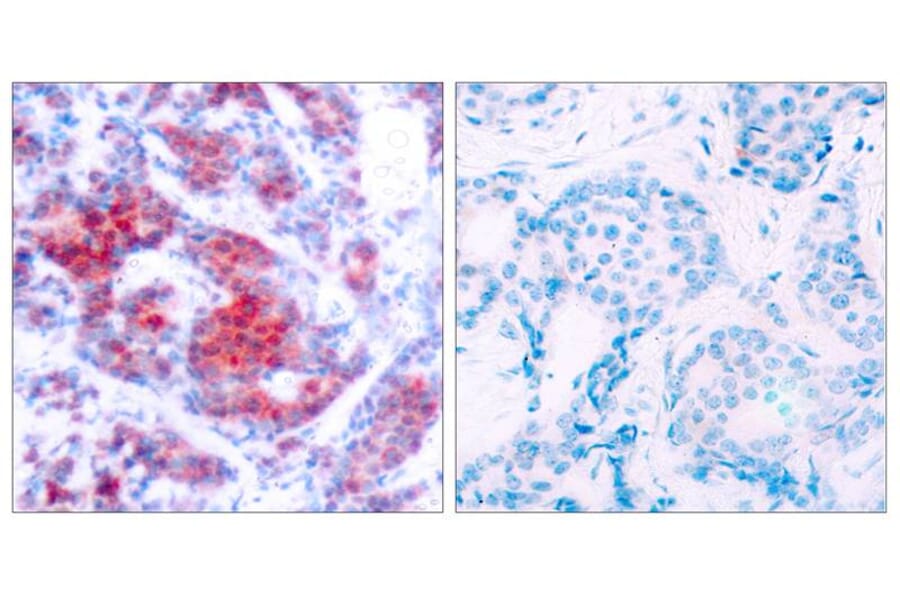 Immunohistochemistry - STAT4 (Phospho-Tyr693) Antibody from Signalway Antibody (11047) - Antibodies.com