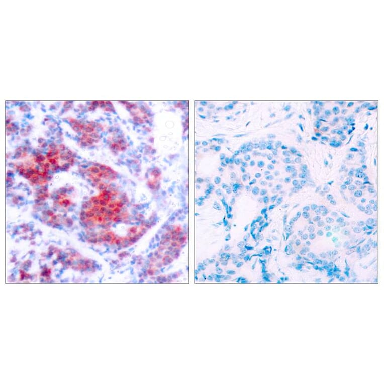 Immunohistochemistry - STAT4 (Phospho-Tyr693) Antibody from Signalway Antibody (11047) - Antibodies.com