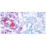 Immunohistochemistry - STAT4 (Phospho-Tyr693) Antibody from Signalway Antibody (11047) - Antibodies.com