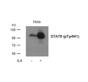 Western blot - STAT6 (Phospho-Tyr641) Antibody from Signalway Antibody (11050) - Antibodies.com