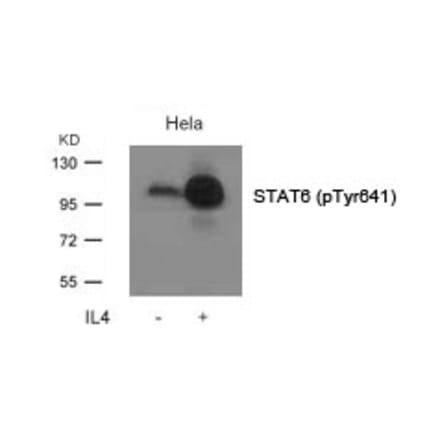 Western blot - STAT6 (Phospho-Tyr641) Antibody from Signalway Antibody (11050) - Antibodies.com