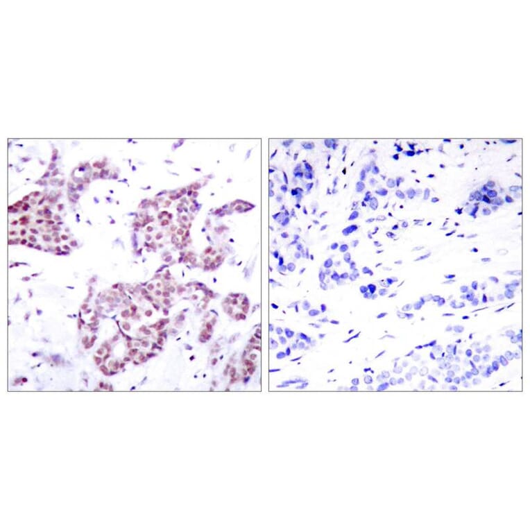 Immunohistochemistry - STAT6 (Phospho-Tyr641) Antibody from Signalway Antibody (11050) - Antibodies.com