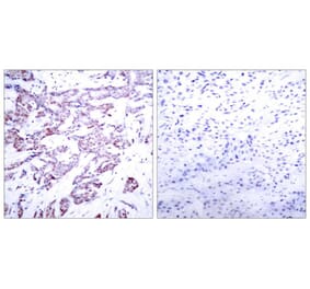 Immunohistochemistry - STAT6 (Phospho-Thr645) Antibody from Signalway Antibody (11051) - Antibodies.com