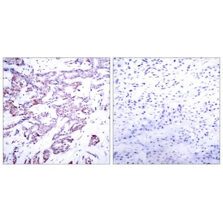 Immunohistochemistry - STAT6 (Phospho-Thr645) Antibody from Signalway Antibody (11051) - Antibodies.com