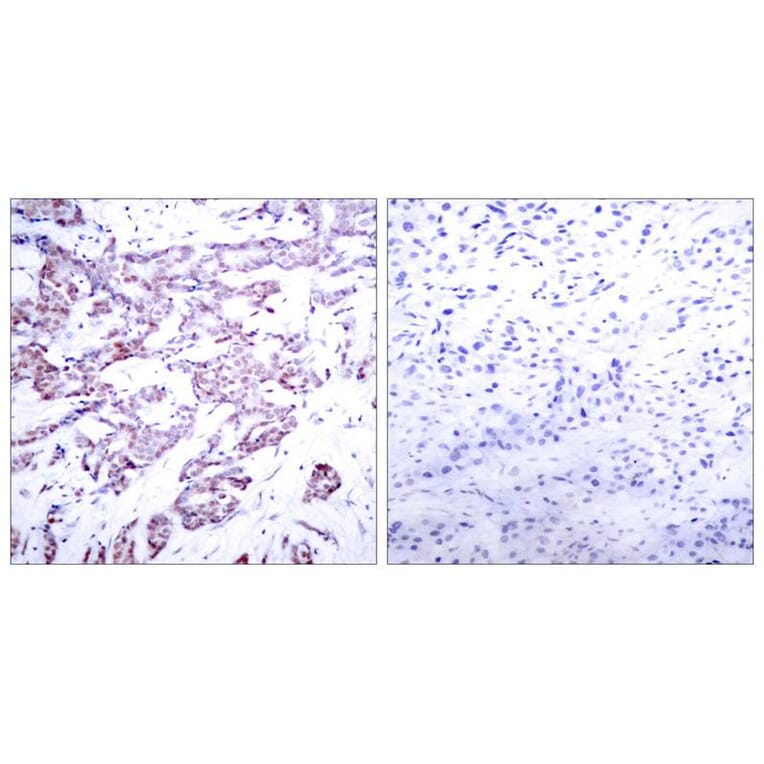 Immunohistochemistry - STAT6 (Phospho-Thr645) Antibody from Signalway Antibody (11051) - Antibodies.com