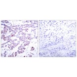 Immunohistochemistry - STAT6 (Phospho-Thr645) Antibody from Signalway Antibody (11051) - Antibodies.com