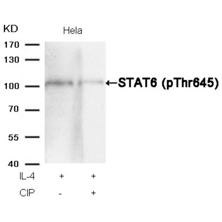 Western blot - STAT6 (Phospho-Thr645) Antibody from Signalway Antibody (11051) - Antibodies.com