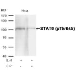 Western blot - STAT6 (Phospho-Thr645) Antibody from Signalway Antibody (11051) - Antibodies.com