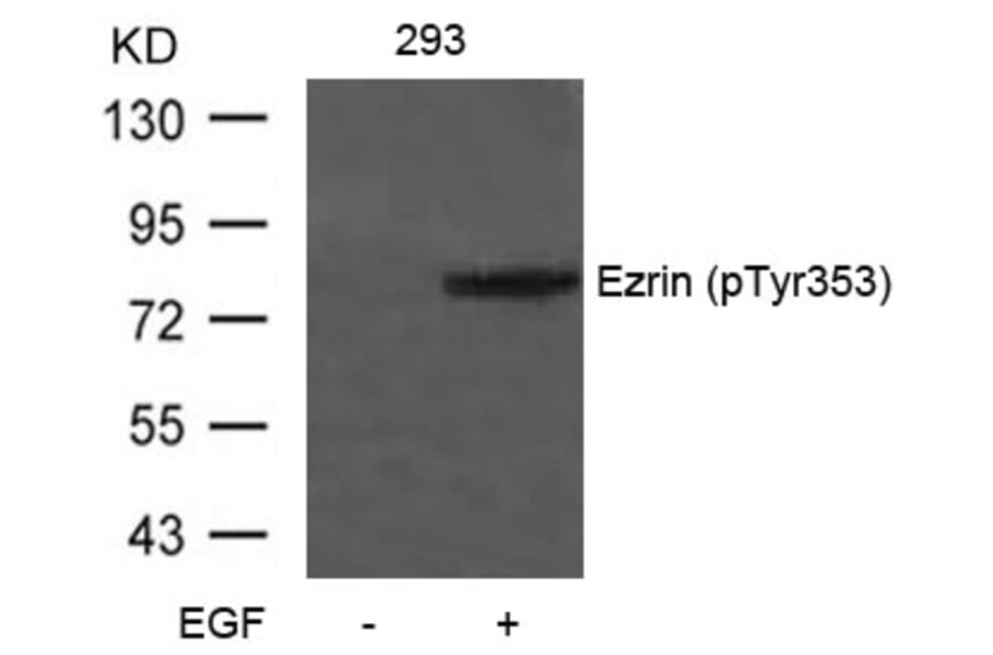 Western blot - Ezrin (Phospho-Tyr353) Antibody from Signalway Antibody (11063) - Antibodies.com