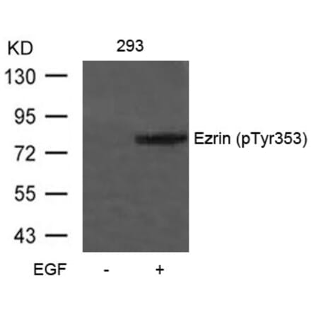 Western blot - Ezrin (Phospho-Tyr353) Antibody from Signalway Antibody (11063) - Antibodies.com