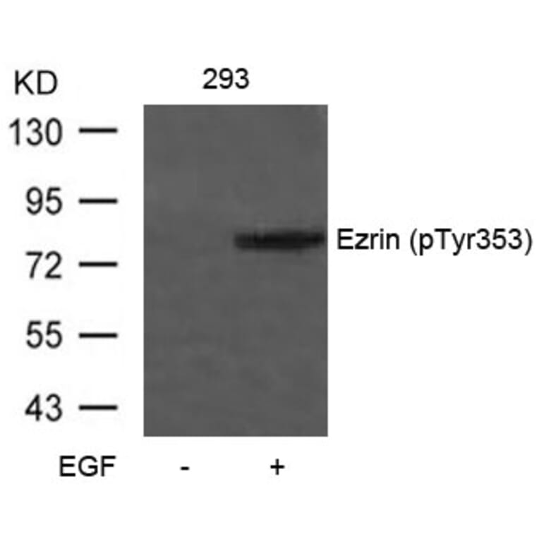 Western blot - Ezrin (Phospho-Tyr353) Antibody from Signalway Antibody (11063) - Antibodies.com