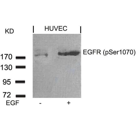 Western blot - EGFR (Phospho-Ser1070) Antibody from Signalway Antibody (11080) - Antibodies.com