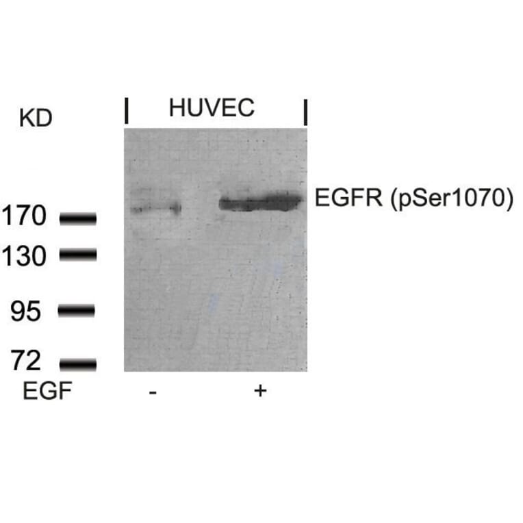 Western blot - EGFR (Phospho-Ser1070) Antibody from Signalway Antibody (11080) - Antibodies.com