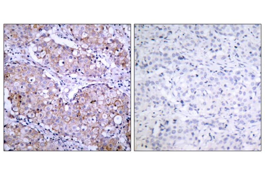 Immunohistochemistry - EGFR (Phospho-Ser1070) Antibody from Signalway Antibody (11080) - Antibodies.com