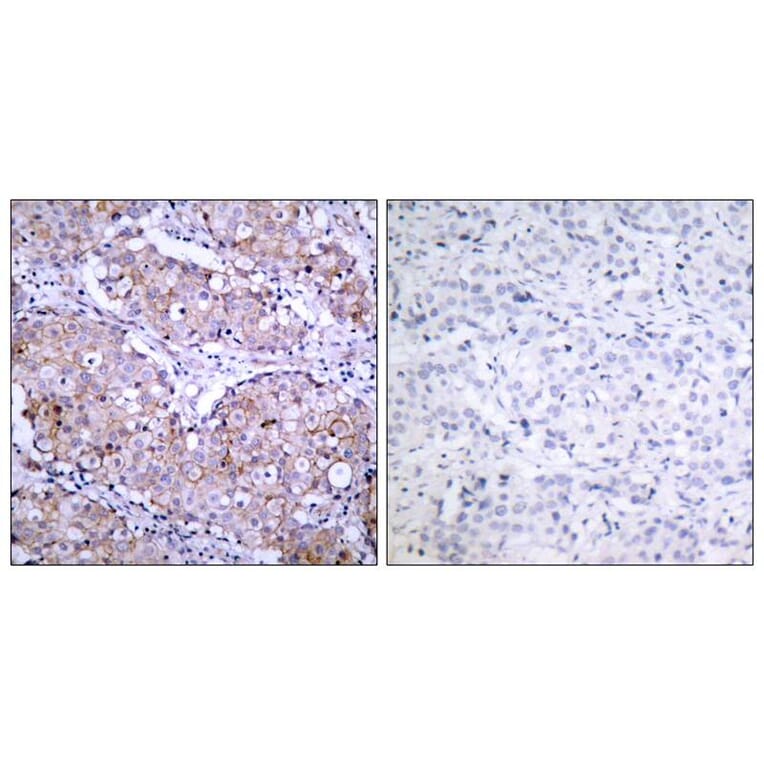 Immunohistochemistry - EGFR (Phospho-Ser1070) Antibody from Signalway Antibody (11080) - Antibodies.com