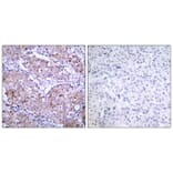 Immunohistochemistry - EGFR (Phospho-Ser1070) Antibody from Signalway Antibody (11080) - Antibodies.com