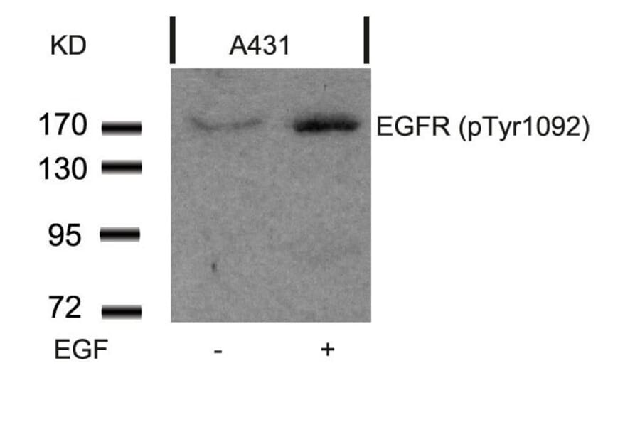 Western blot - EGFR (Phospho-Tyr1092) Antibody from Signalway Antibody (11081) - Antibodies.com