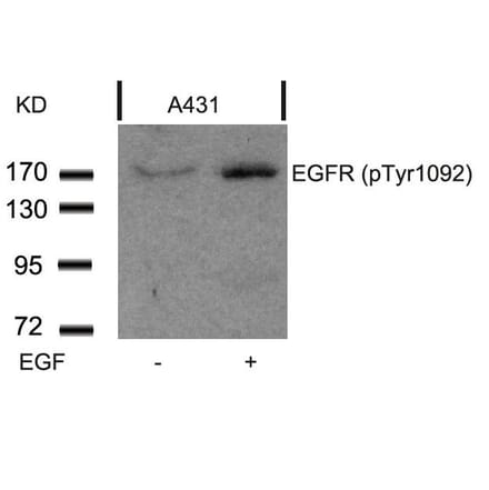 Western blot - EGFR (Phospho-Tyr1092) Antibody from Signalway Antibody (11081) - Antibodies.com