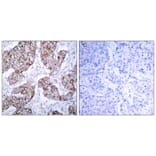 Immunohistochemistry - EGFR (Phospho-Tyr1092) Antibody from Signalway Antibody (11081) - Antibodies.com