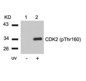 Western blot - CDK2 (Phospho-Thr160) Antibody from Signalway Antibody (11133) - Antibodies.com