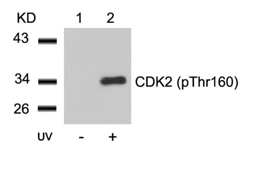 Western blot - CDK2 (Phospho-Thr160) Antibody from Signalway Antibody (11133) - Antibodies.com