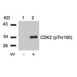 Western blot - CDK2 (Phospho-Thr160) Antibody from Signalway Antibody (11133) - Antibodies.com