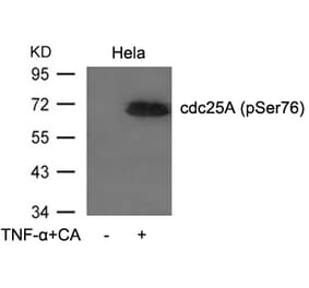 Western blot - cdc25A (Phospho-Ser76) Antibody from Signalway Antibody (11138) - Antibodies.com