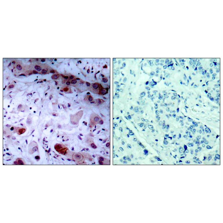 Immunohistochemistry - JAK1 (Phospho-Tyr1022) Antibody from Signalway Antibody (11149) - Antibodies.com