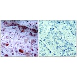 Immunohistochemistry - JAK1 (Phospho-Tyr1022) Antibody from Signalway Antibody (11149) - Antibodies.com