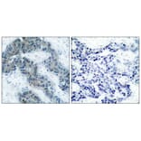 Immunohistochemistry - Jak2 (Phospho-Tyr1007) Antibody from Signalway Antibody (11151) - Antibodies.com