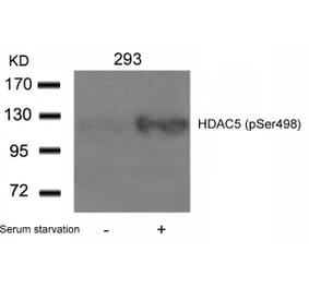 Western blot - HDAC5 (Phospho-Ser498) Antibody from Signalway Antibody (11193) - Antibodies.com